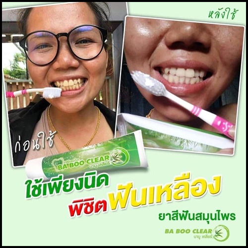 ยาสีฟันบาบูเคลียร์ BABOO CLEAR ยาสีฟัน สมุนไพรสูตรเข้มข้น
