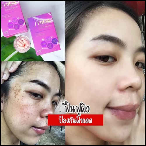 ชิดะคอลลาเจน Shida Collagen