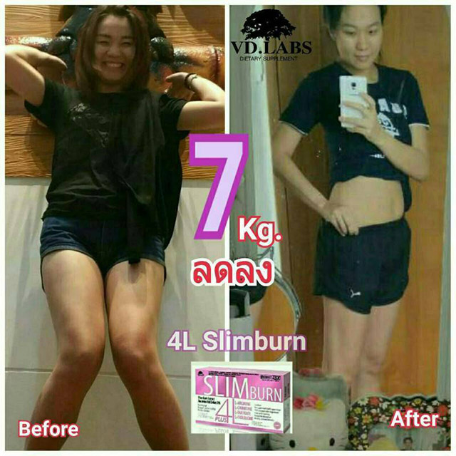 4L Slim burn โฟร์ แอล สลิม เบิร์น พลัส ลดน้ำหนัก 30 แคปซูล