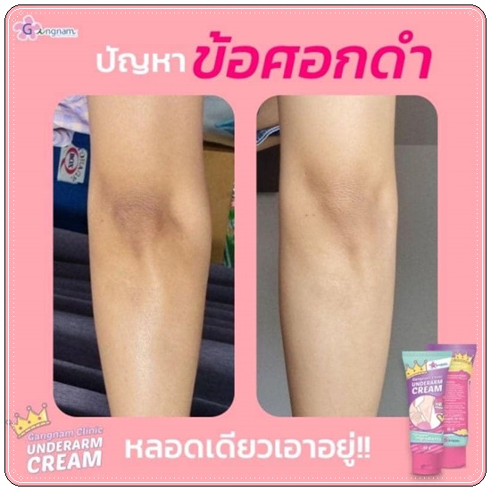 ครีมทารักแร้ขาว กังนัมคลีนิค Gangnam Clinic Underarm Cream