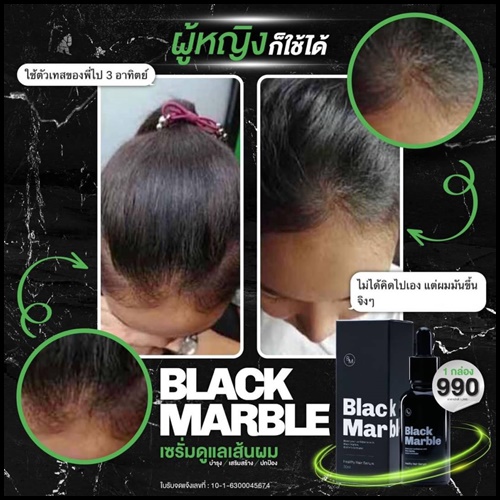 Black Marble Serum เซรั่มดูแลเส้นผม (ส่งฟรี)