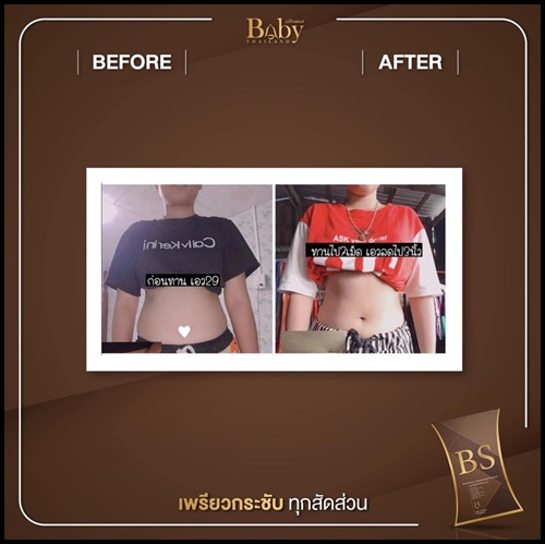 BS ลดน้ำหนัก By BabyThailand ส่งฟรี
