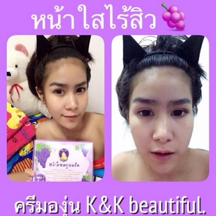ใหม่ เซตครีมองุ่นหน้าใส K&K Beautiful (10กรัม)