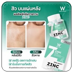 Zinc Wink White ซิงค์วิ้งไวท์ (1แถม1)
