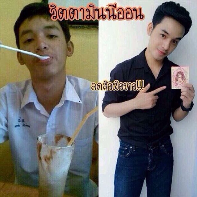 ขาย วิตามินนีออน วิตามินผิวขาว by นีออน ปลีก-ส่ง
