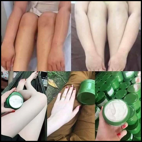 ครีมเวียดนามผิวขาว Body cream no.1