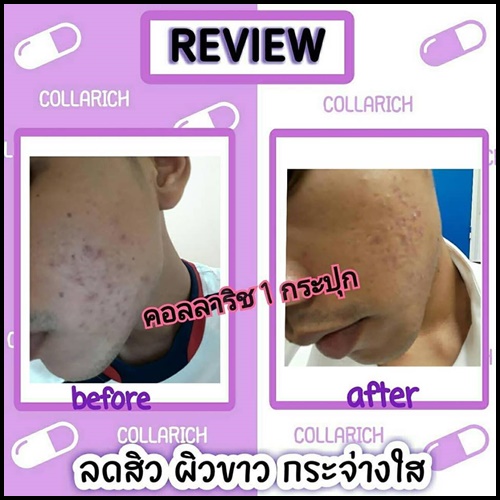 คอลล่าริช คอลลาเจน COLLARICH COLLAGEN