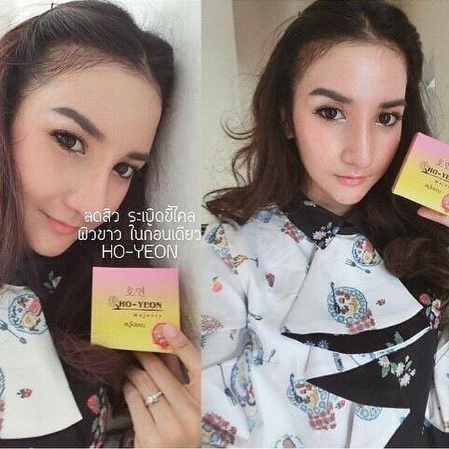 สบู่โฮยอน ระเบิดขี้ไคล ขาวออร่า (Ho-Yeon)