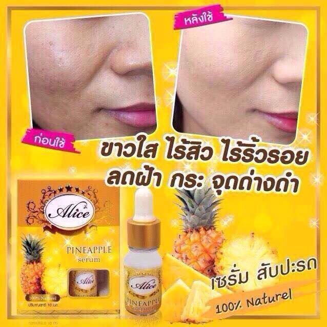 เซรั่มสับปะรด aha100% by Alice