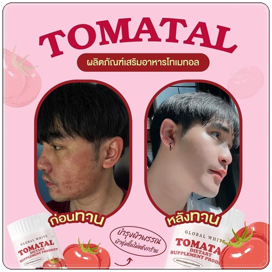 น้ำชงมะเขือเทศ โทเมทอล Global White Tomatal