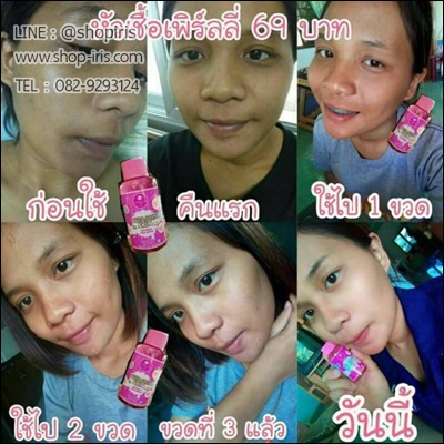 หัวเชื้อเพิร์ลลี่ vitamin skin body serum perlly