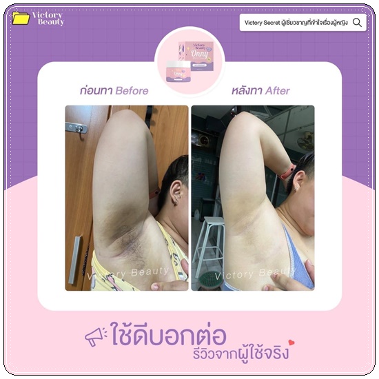 ออนนี่ ครีมรักแร้ขาว Onny White Cream VictoryBeauty