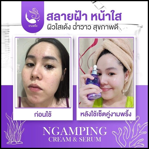 เซ็ตงามพริ้ง Ngampring ครีมงามพริ้ง แถมฟรี เซรั่มงามพริ้ง (1แถม1)