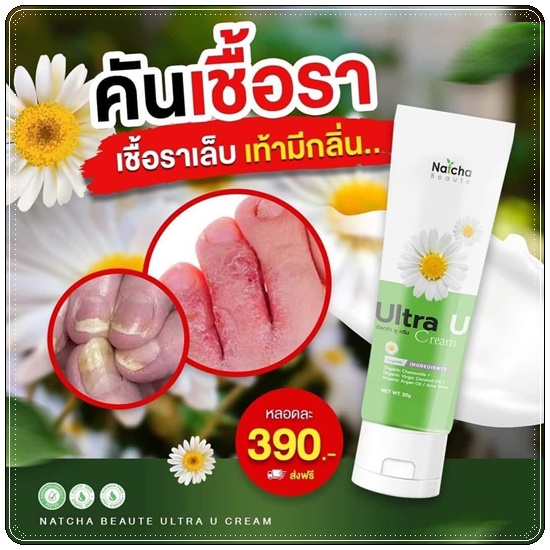 อัลตร้า ยู ครีม Ultra U Cream Natcha ลดอาการคัน กลากเกลื้อน