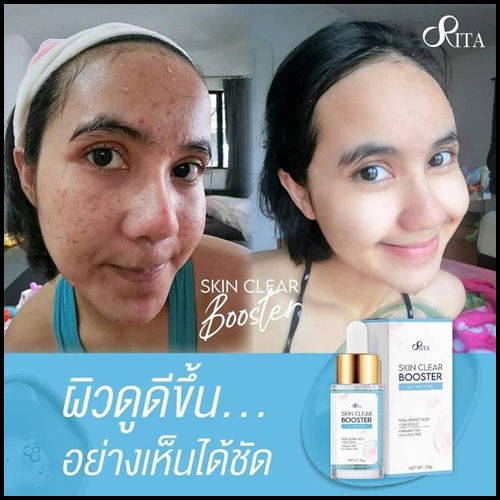 เซรั่มริต้า Rita Skin Clear Booster Serum เคลีย์ สกิน บูสเตอร์