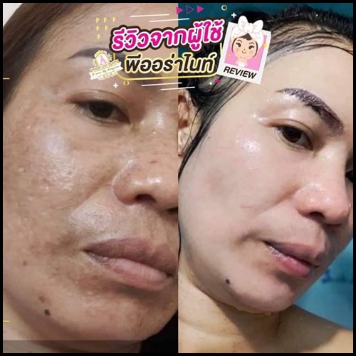 พีออร่าไนท์ ไวท์เทนนิ่ง P Aura Night Whitening แพคเกตใหม่ ของแท้