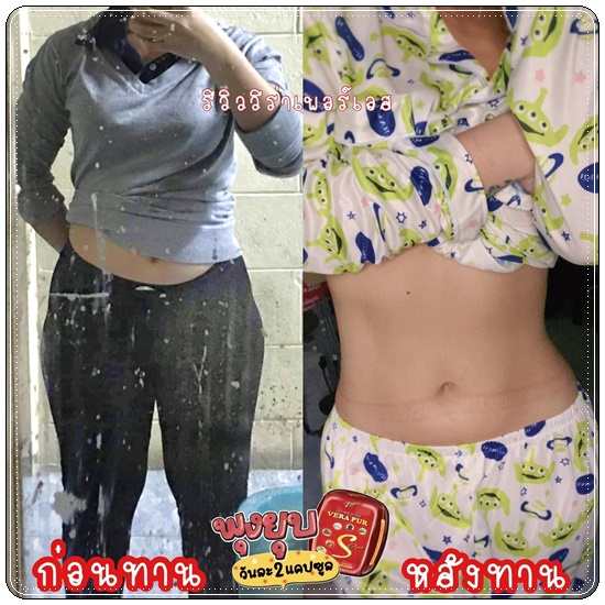 วีร่า เพอร์ เอส พลัส VERA PUR S Plus (แพ็คเกตใหม่)