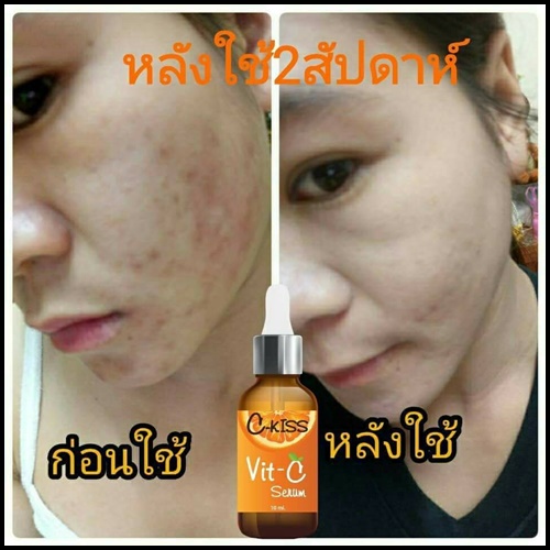 ซีคิส วิตซี เซรั่ม C-Kiss Vit-C Serum