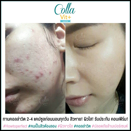 คอลล่าวิต พลัส ใหม่ CollaVit+