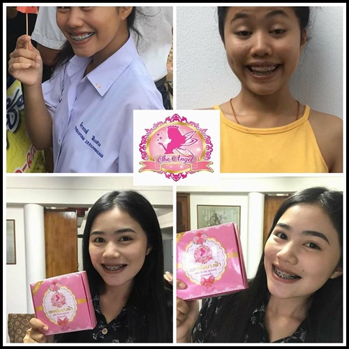 ครีมนางฟ้า The Angel Cream ครีมหน้าใส