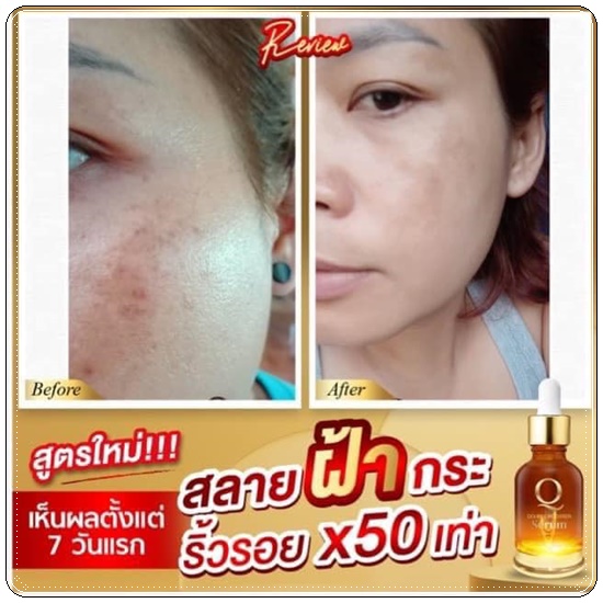 คิวดับเบิ้ลบูธเตอร์เซรั่ม Q Double Booster Serum (ส่งฟรี)