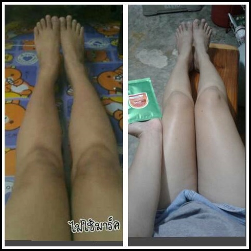 มาร์คผิวขาววิตามินซี LADA by Nang