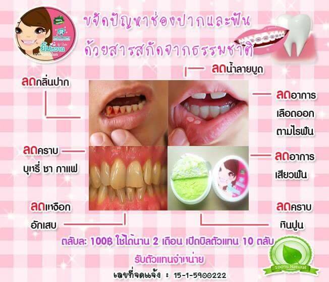 ยาสีฟันยิ้มหวาน By Butin