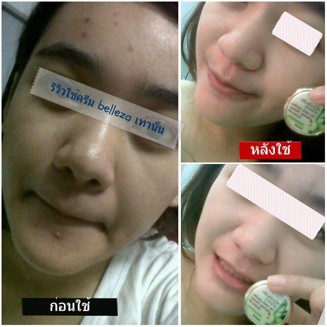 Belleza ครีมแอบเปิ้ลสาหร่าย (แพ็คเกจใหม่)
