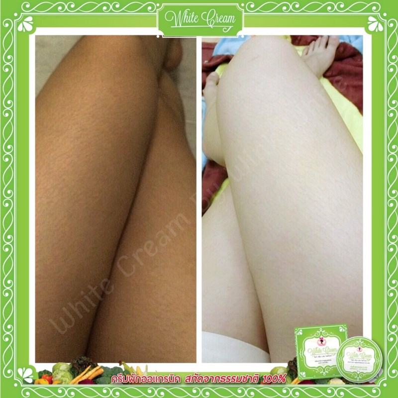 ครีมหัวเชื้อเร่งผิวขาวไวท์ครีม บายวิงค์ไวท์ (WHITE CREAM BY WINK WHITE)