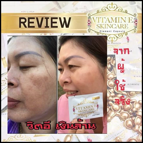 วิตามินอี บำรุงผิวหน้า By Nifty (Vitamin E Skincare)