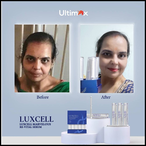 เซรั่มหน้าเด็ก Luxcell คุณภาพระดับสเต็มเซลล์ ของแท้