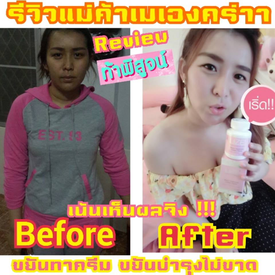 รีวิว & ขาย LIZE' ลิเซ่ อนุพันธ์ วิตามินรวม