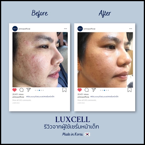 เซรั่มหน้าเด็ก Luxcell คุณภาพระดับสเต็มเซลล์ ของแท้