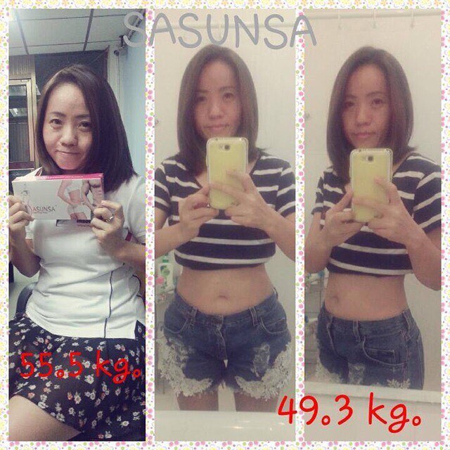 SASUNSA ซาซันซ่า ลดน้ำหนัก เซ็ตเดียวเอาอยู่