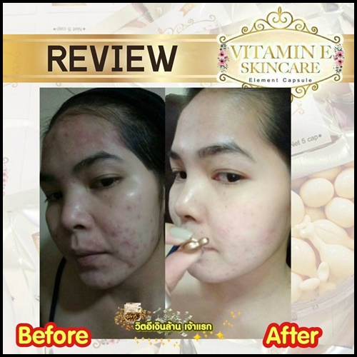 วิตามินอี บำรุงผิวหน้า By Nifty (Vitamin E Skincare)