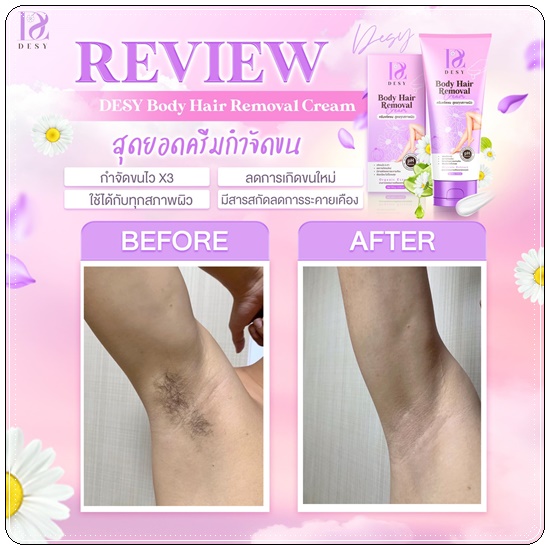 เดซี่ครีมขจัดขน DESY Body Hair Removal Cream (ส่งฟรี)