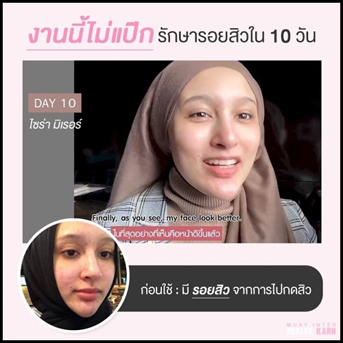 Jelly Mask Up by LANOS เจลลี่มาส์กหน้าลดสิว (ของแท้ ส่งฟรี)