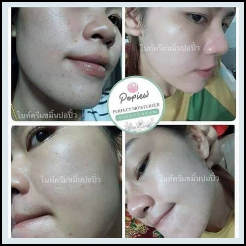 ไนท์ครีมปอปิ๋ว Popiew Nigth Cream ครีมขมิ้น ลดสิว ลดฝ้า