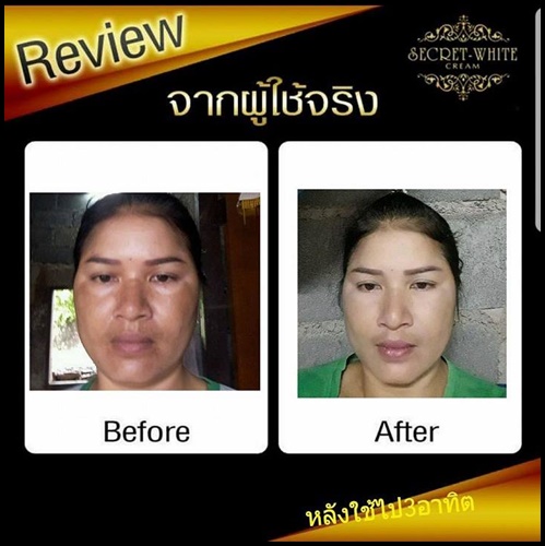 ครีมแก้ฝ้า หน้าใส By Secret white cream