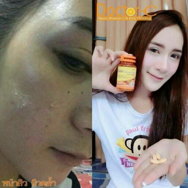 Nano Vitamin C & Zinc By Doctor-C