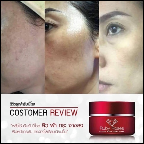 รับบี้ โรส ครีม Ruby Roses Cream ครีมรากหญ้า