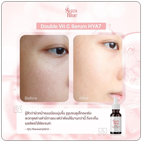 เซรั่มออร่าบลู Aura Blue Double Vitamin C Serum+HYA (ของแท้)