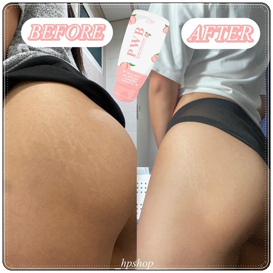 ครีม PWB Prink White Bumm