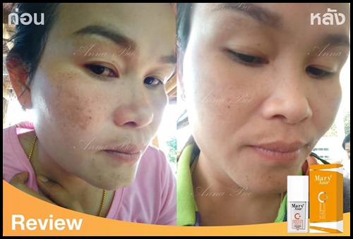 เซรั่มวิตซี สลายฝ้า มารีแอน Mary Ann (โปรส่งฟรี)