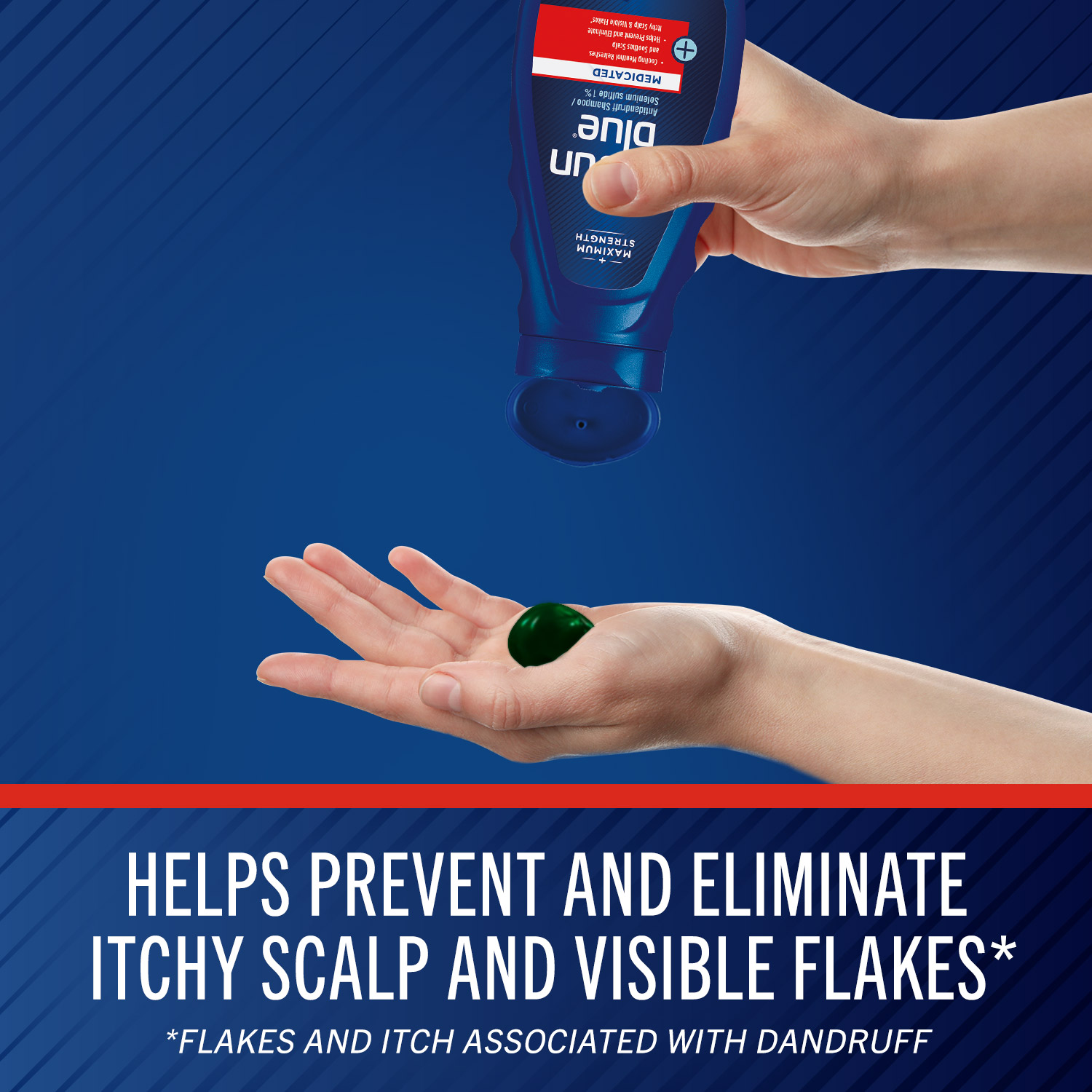 แชมพูขจัดรังแค สำหรับผู้ชาย Selsun Blue Medicated Max Strength Dandruff Shampoo กลิ่น เมนทอล ขนาด 11 ออนซ์