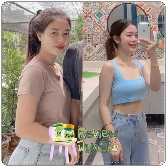 Need U ยูนีด The Richs (Finn&Fin Plus ฟินแอนด์เฟิร์ม แพ็คเกตใหม่)