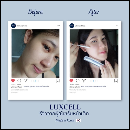 เซรั่มหน้าเด็ก Luxcell คุณภาพระดับสเต็มเซลล์ ของแท้
