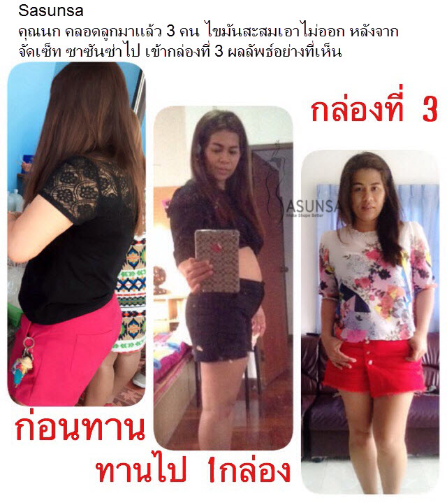 SASUNSA ซาซันซ่า ลดน้ำหนัก เซ็ตเดียวเอาอยู่