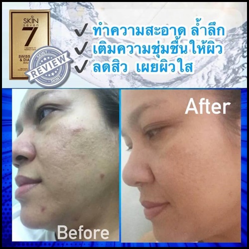 สบู่สกินเซเว่น SKIN 7 SWISS GOLD&DIAMOND BEAUTY SOAP