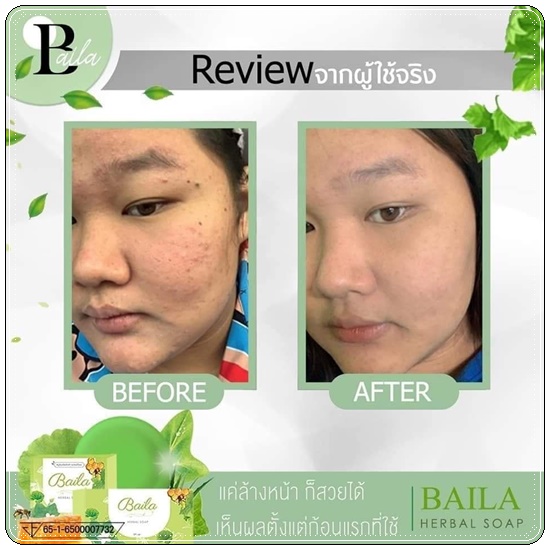 สบู่ใบล่า Baila Herbal Soap DAIME